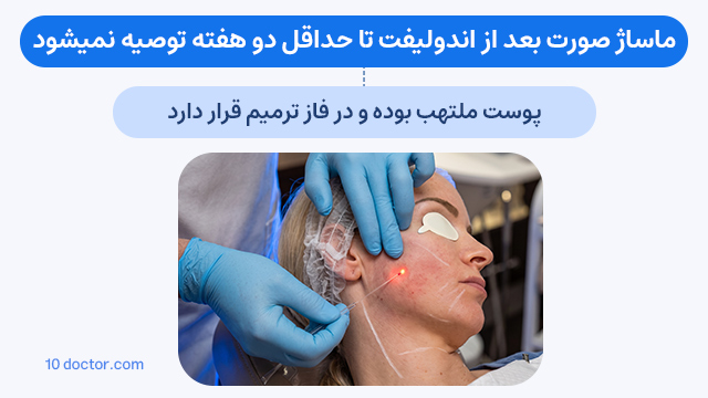 ماساژ صورت بعد از اندولیفت تا حداقل دو هفته توصیه نمیشود.