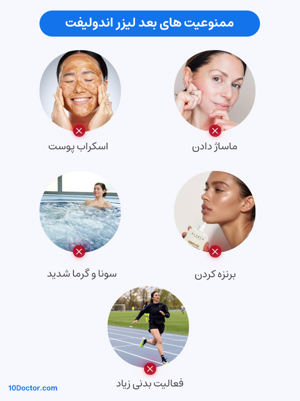 ممنوعیت های بعد لیزر اندولیفت