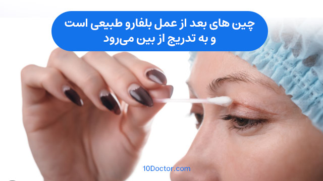 چین های بعد از عمل بلفارو طبیعی است و به تدریج از بین می‌رود.