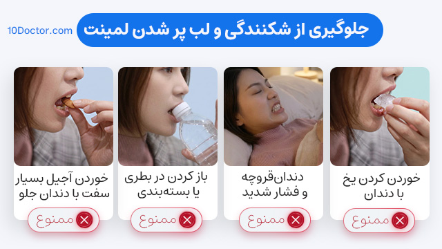 جلوگیری از شکنندگی و لب پر شدن لمینت