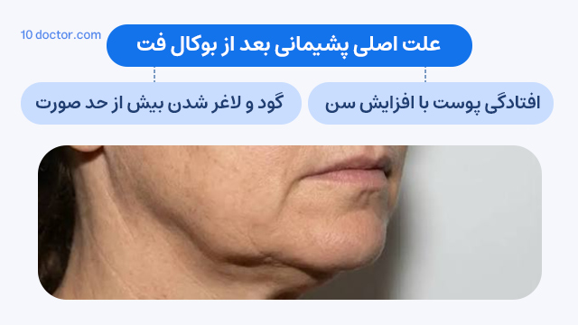 علت اصلی پشیمانی بعد از بوکال فت 