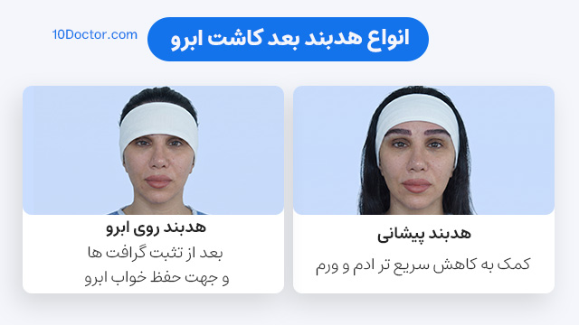 انواع هدبند بعد کاشت ابرو