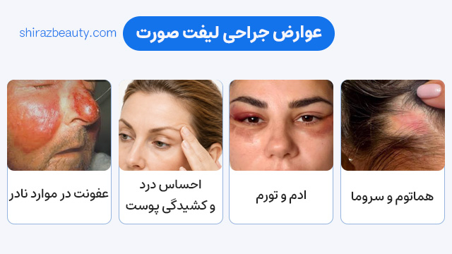 زعوارض جراحی لیفت صورت