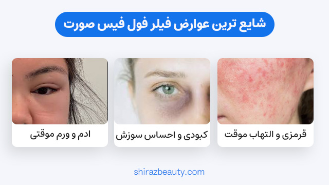 عوارض تزریق فیلر فول فیس